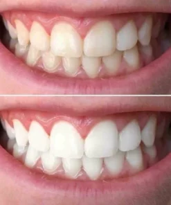 Oveallgo™ Whitening Purple Mousse Toothpaste