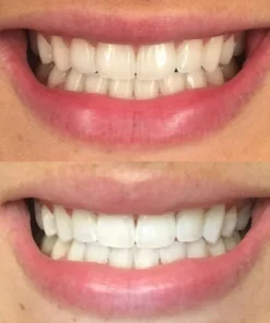 Oveallgo™ Whitening Purple Mousse Toothpaste