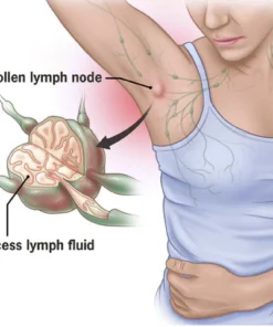 Oveallgo™ Womans Wellness Lymph Care Patch