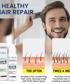 Oveallgrow™ ScalpRevive Minoxidil Growth Roller