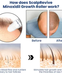 Oveallgrow™ ScalpRevive Minoxidil Growth Roller