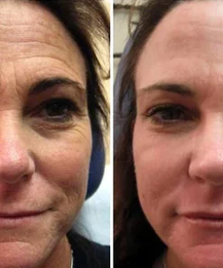 Peeluxe™ Yeast Egg Shell Mask Cream