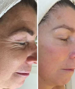 Peeluxe™ Yeast Egg Shell Mask Cream