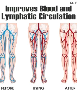 RICPIND AntiEdema ThermaRelax Compression Socks