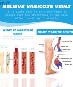 Ricpind MagneticTherapy SwellReduce Acupressure Insoles