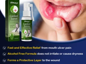 SOUTH MOON™ Canker Sores Spray