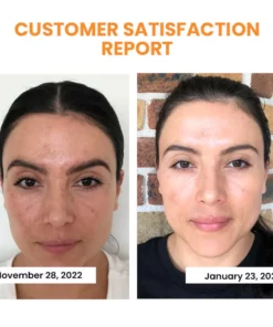 Tensund™ Korean Technology Soluble Collagen Film