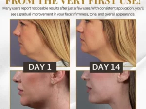 V-Shape™ Slimming Mask