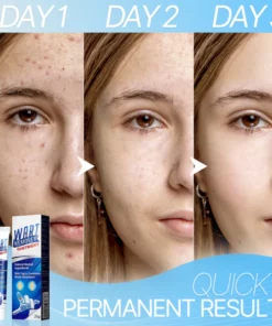 WART-LESS Immediate Blemish Removal Cream