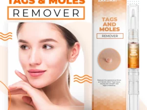 Zakdavi™️ Tags And Moles Remover