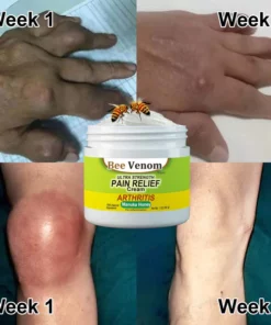 Zealand Bee Venom Joint and Bone Therapy Advanced Cream