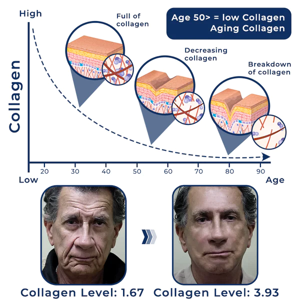 Kem Collagen Flysmus™ Men's AgeRevive