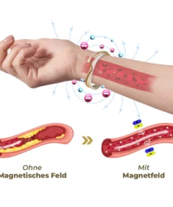 flysmus™ GemGemini Magnetogen Armreif