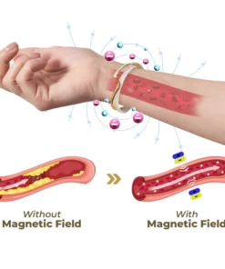 flysmus™ GemGemini Magnetogen Bangle