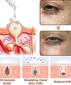 flysmus™ Milk Spots Treatment Essence