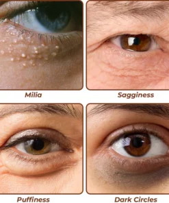 flysmus™ Milk Spots Treatment Essence