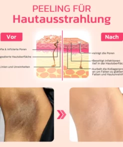 flysmus™ VIO Aufhellende rosafarbene Essenz