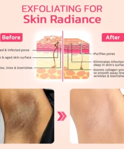 flysmus™ VIO Whitening Pinkish Essence