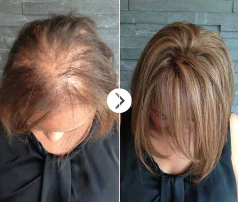 Ceoerty™ GingerEssence Hair Growth Serum