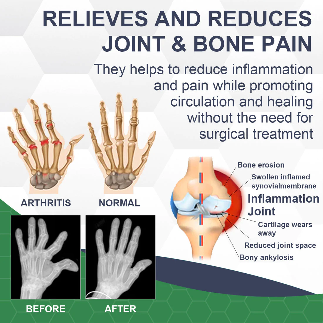 Cvreoz™ Bee Venom Pain and Bone Healing Cream