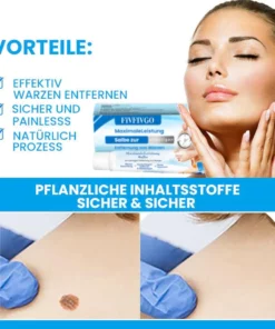 Fivfivgo™ MaximaleLeistung Salbe zur sofortigen Entfernung von Warzen