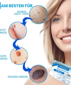 Fivfivgo™ MaximaleLeistung Salbe zur sofortigen Entfernung von Warzen