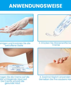 Fivfivgo™ MaximaleLeistung Salbe zur sofortigen Entfernung von Warzen