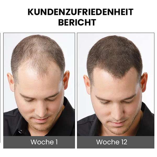 Furzero™ ShougaGRO Japanisches Haarwachstumsspray - Image 6