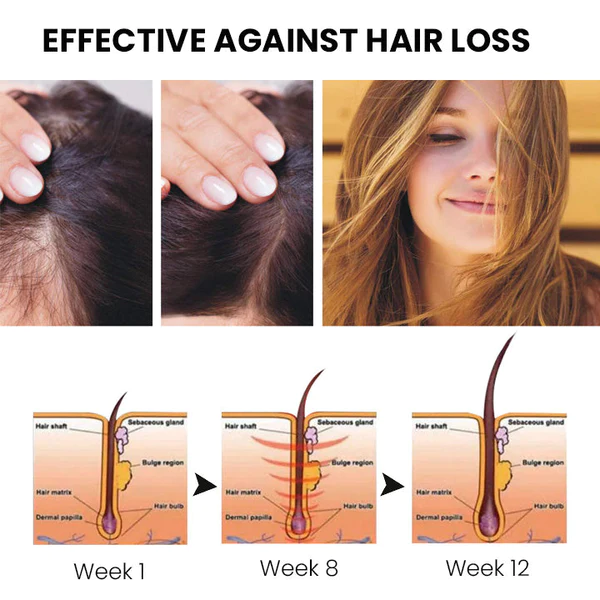 Furzero™ ShougaGRO Japanisches Haarwachstumsspray - Image 3