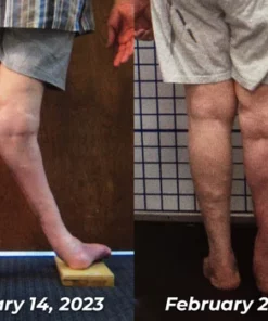 GFOUK™ ArthiCare Bee Venom Treatment Patch