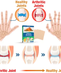 GFOUK™ ArthiCare Bee Venom Treatment Patch