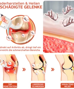 GFOUK™ DeerAntler Gelenk- und Knochentherapie-Balsam