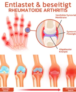 GFOUK™ DeerAntler Gelenk- und Knochentherapie-Balsam
