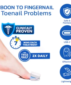 GFOUK™ FungusOFF Nail Laser Treatment Device