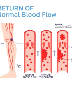 GFOUK™ IONSDETOX Tourmaline Acupressure Self-heating Silk Stocks