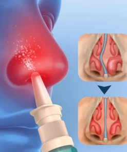 GFOUK™ NasoCalm Wellness für die Nase und Turbinate Comfort Spray