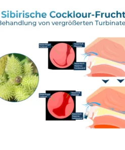 GFOUK™ NasoCalm Wellness für die Nase und Turbinate Comfort Spray