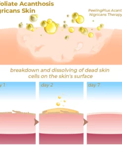 GFOUK™ PeelingPlus Acanthosis Nigricans Therapy Oil