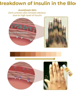 GFOUK™ PeelingPlus Acanthosis Nigricans Therapy Oil