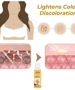 GFOUK™ PeelingPlus Acanthosis Nigricans Therapy Oil