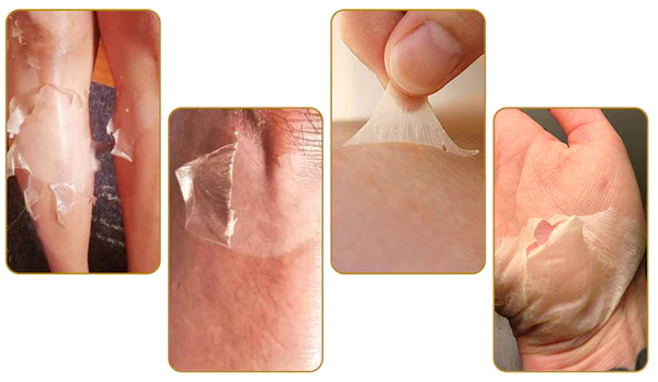 GFOUK™ PeelingPlus Acanthosis Nigricans Therapy Oil 