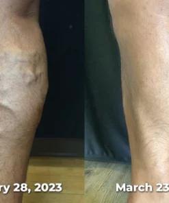 GFOUK™ SwellGuard Self-Heating Lymphatic Sleeves