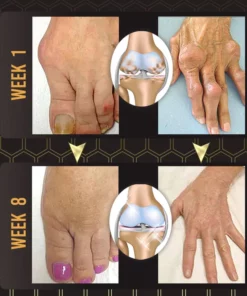 Joint Soothe™ Bee Venom Joint Relief Gel