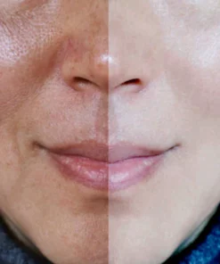 LIMETOW™ Black Tea Peeling Mask