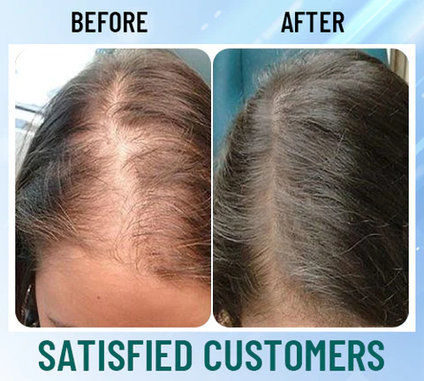 Nurbini™ EMS Hair Reborn Scalp Acupoint Massager