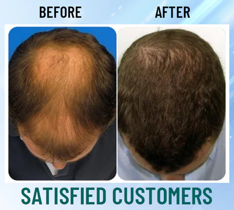 Nurbini™ EMS Hair Reborn Scalp Acupoint Massager 