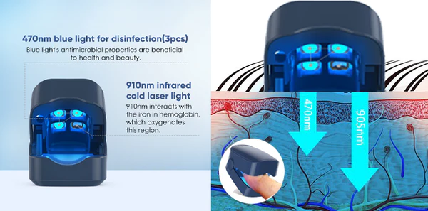 Oveallgo™ Revolutionary PharmaPro High-Efficiency Light Therapy Device For Toenail Diseases