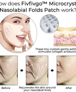 Oveallgo™ Microcrystal Nasolabial Folds Patch
