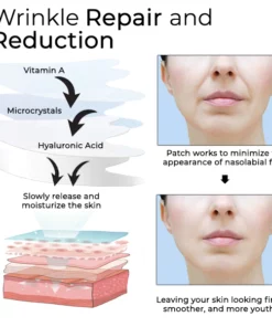 Oveallgo™ Microcrystal Nasolabial Folds Patch