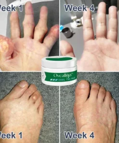 Oveallgo™ PRO Crema curativa para el dolor y los huesos con veneno de abeja